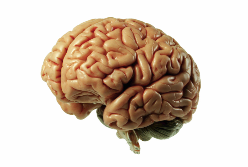 a human brain
