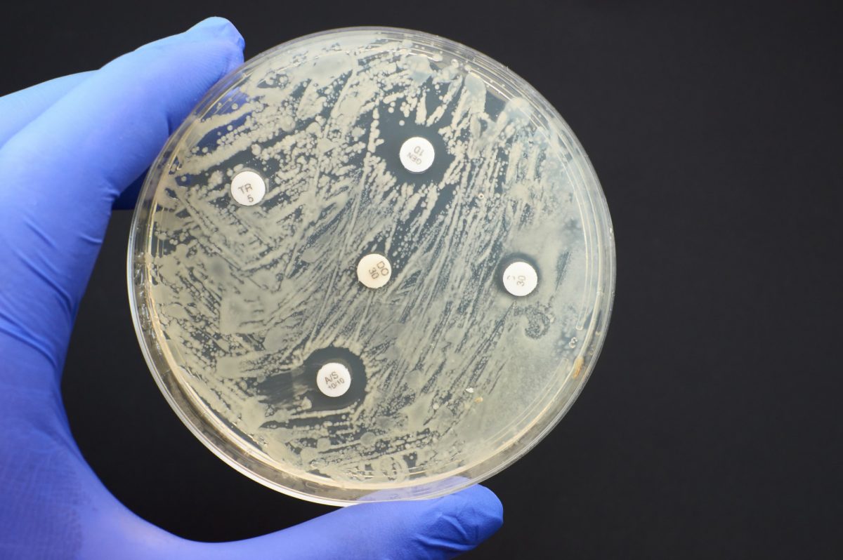 Antibiotic sensitivity test done in a petri dish.