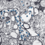 Transmission electron microscopic image of an isolate from the first U.S. case of COVID-19, formerly known as 2019-nCoV. The spherical viral particles, colorized blue, contain cross-sections through the viral genome, seen as black dots.