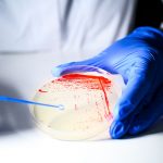 Bacterial colonies on agar plate