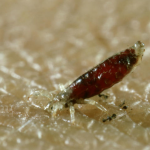 CDC warns of infection spread via body lice in homeless populations © Alastair Macewen/Getty Images