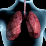 Graphic showing human lungs inside a person's body